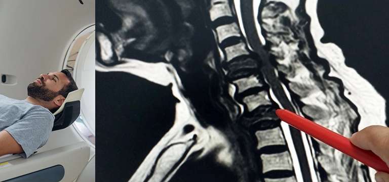 Understanding the Hidden Pathways of Spine MRI